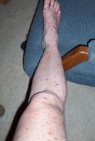 stained leg.jpg